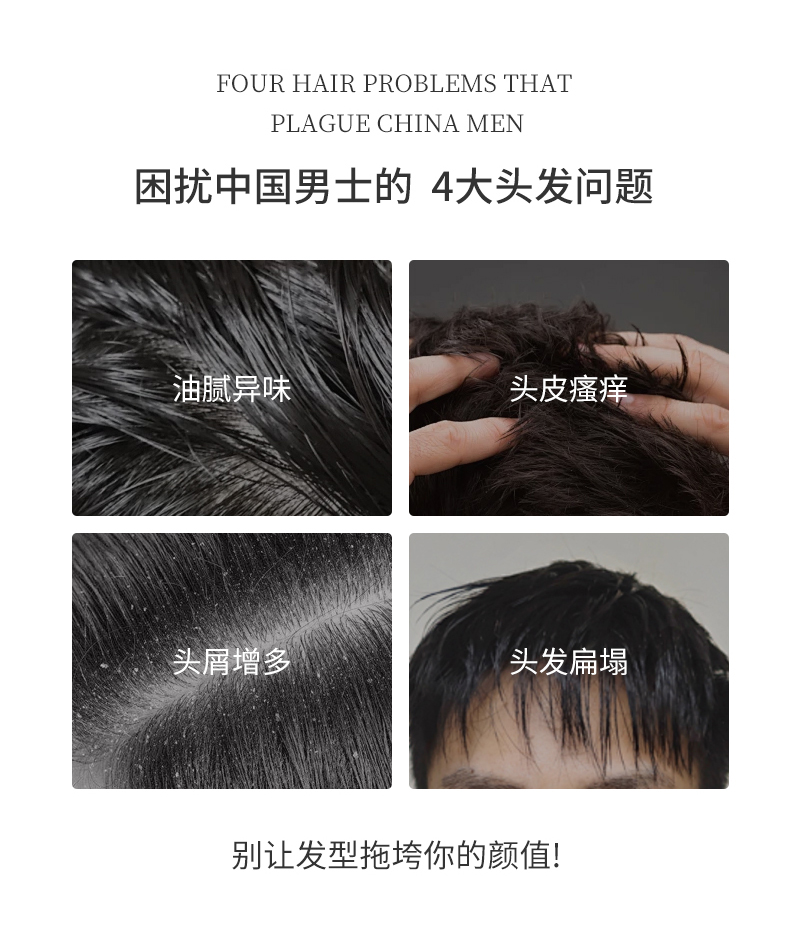 困擾中國(guó)男士的四大問(wèn)題，油膩異味、頭皮瘙癢、頭屑增多、頭發(fā)扁塌